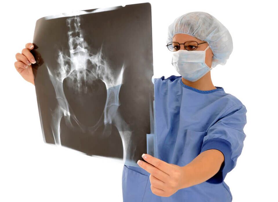 X-ray of the hip joint will help the doctor determine the cause of the pain