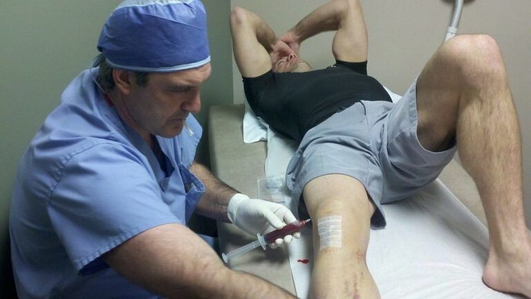 The treatment of arthrosis of the knee joint